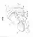 Fig. 03 - Braking device
