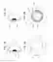 Fig. 02 - Ophthalmic lens system capable of interfacing with an external device
