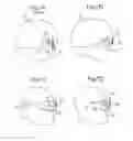 Fig. 02 - Head mounted display