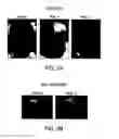 Fig. 08 - Activation of myeloid-derived suppressor cells as a predictor of patient response to interferon-A therapy