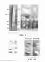 Fig. 02 - METHODS FOR TREATMENT OF CERVICAL INSUFFICIENCY