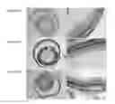 Fig. 09 - COMPOSITIONS FOR TREATING UVEITIS