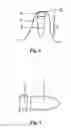 Fig. 02 - IMPLANT AND DENTAL PROSTHESES SYSTEM