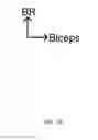 Fig. 08 - Device and method for treating abnormal muscle function