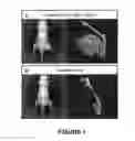 Fig. 02 - PRODUCTS COMPRISING AN EXTRACELLULAR MATRIX MATERIAL AND OSTEOGENIC PROTEIN