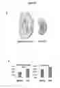 Fig. 07 - Methods for treating polycystic kidney disease