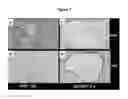 Fig. 08 - Methods for treating polycystic kidney disease