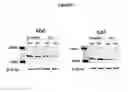 Fig. 09 - Methods for treating polycystic kidney disease