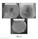 Fig. 12 - Antimicrobial polymer-graphene-silver nanocomposite