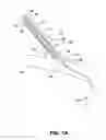 Fig. 02 - Skin interface device for cardiac assist device