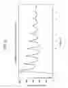 Fig. 11 - PULSE WAVE MEASURING DEVICE