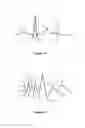 Fig. 02 - Method and apparatus for determining information indicative of cardiac malfunctions and abnormalities
