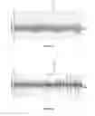 Fig. 07 - Method and apparatus for determining information indicative of cardiac malfunctions and abnormalities