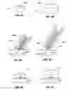 Fig. 09 - REDUNDANT TISSUE CLOSURE METHODS AND APPARATUSES
