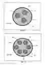 Fig. 07 - Catheter lumen partitioner