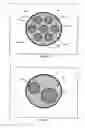 Fig. 08 - Catheter lumen partitioner