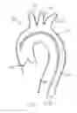 Fig. 07 - Introducer sheath with embolic protection