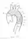 Fig. 08 - Introducer sheath with embolic protection
