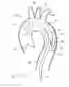Fig. 09 - Introducer sheath with embolic protection
