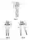 Fig. 09 - Systems for vertebral adjustments and rod reduction