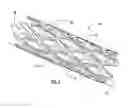 Fig. 02 - Intraluminal Prostheses Having Polymeric Material With Selectively Modified Crystallinity