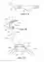 Fig. 06 - Methods and apparatus for FAI surgeries