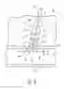 Fig. 03 - Deployment instrument for closure device for percutaneously sealing punctures
