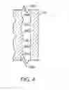 Fig. 06 - Deployment instrument for closure device for percutaneously sealing punctures