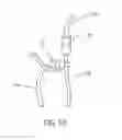 Fig. 12 - Deployment instrument for closure device for percutaneously sealing punctures
