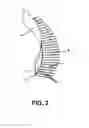 Fig. 03 - Arch Drywall Trim Product