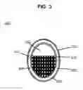 Fig. 04 - Hair Replacement and Method of Use