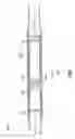 Fig. 10 - Flow bypass device and method