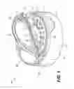 Fig. 02 - Sift-resistant dispensing closure