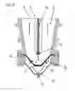 Fig. 09 - Method of fragmenting and/or weakening of material by means of high voltage discharges