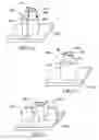 Fig. 06 - Elastic tube alignment and fastening system for providing precise alignment and fastening of components