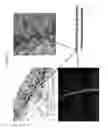Fig. 08 - BIO-SYNTHETIC MATRIX AND USES THEREOF