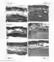 Fig. 02 - Soft tissue and bone augmentation and bulking utilizing muscle-derived progenitor cells, compositions and treatments thereof