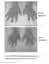 Fig. 02 - Anti-inflammatory ion and uses thereof
