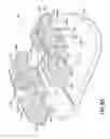 Fig. 43 - Orthodontic appliances and methods of making and using same