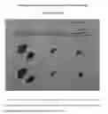 Fig. 02 - Altering cancer cellular functions through proton mopping