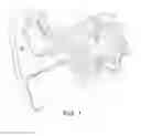 Fig. 02 - Magnet Arrangement for Bone Conduction Hearing Implant