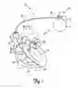 Fig. 02 - Implantable active fixation lead with biodegradable helical tip