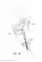 Fig. 29 - SYSTEMS AND METHODS FOR REVASCULARIZATION ASSESSMENT
