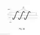 Fig. 07 - FLEXIBLE, STRETCHABLE TROCAR TO FACILITATE SINGLE INCISION LAPAROSCOPIC SURGERY