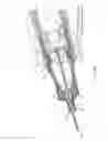 Fig. 06 - Sealed self-activating injection device for delivery of medicine from a prefilled cartridge or vial