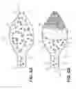 Fig. 07 - Minimally invasive biomaterial injection system