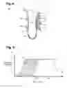 Fig. 04 - Implantable device for evaluating autonomic cardiovascular drive in a patient suffering from chronic cardiac dysfunction