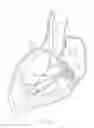 Fig. 06 - Methods and apparatus for endovascularly replacing a heart valve