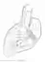 Fig. 07 - Methods and apparatus for endovascularly replacing a heart valve