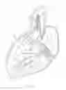 Fig. 09 - Methods and apparatus for endovascularly replacing a heart valve